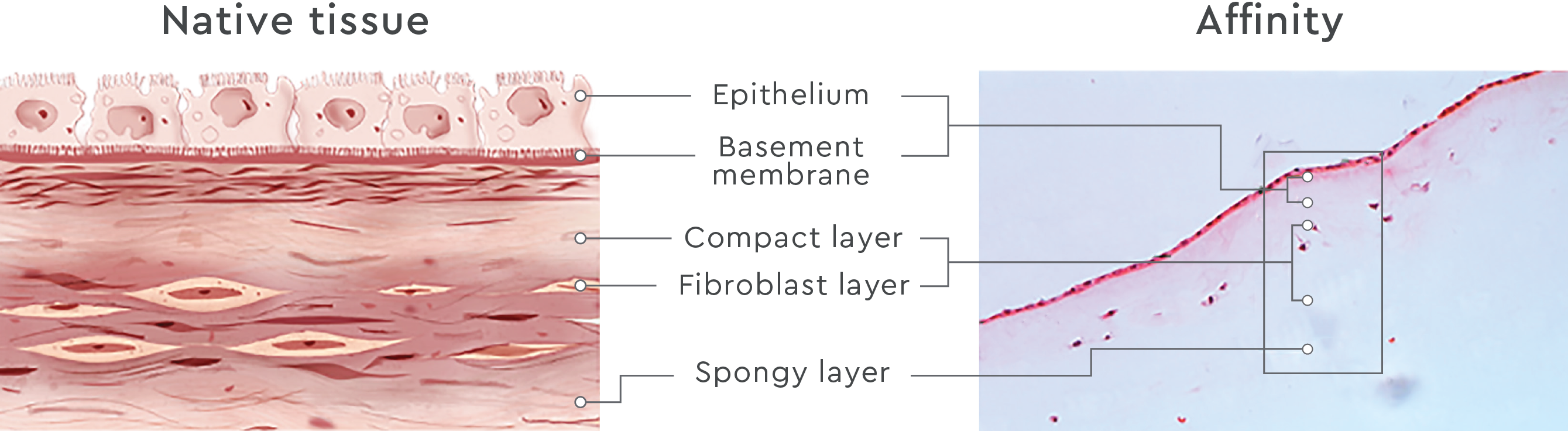 The epithelium, basement membrane, compact layer, fibroblast layer, and spongy layer in Affinity