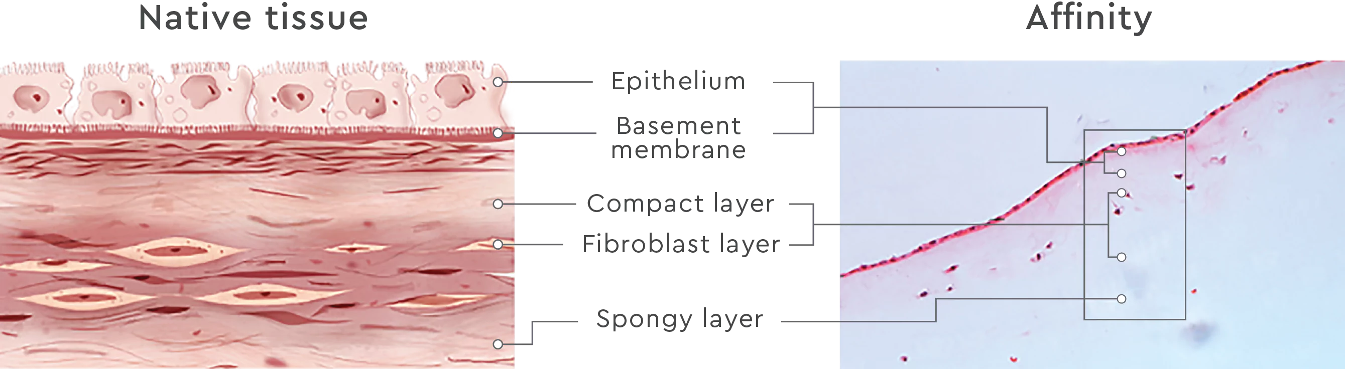 The epithelium, basement membrane, compact layer, fibroblast layer, and spongy layer in Affinity