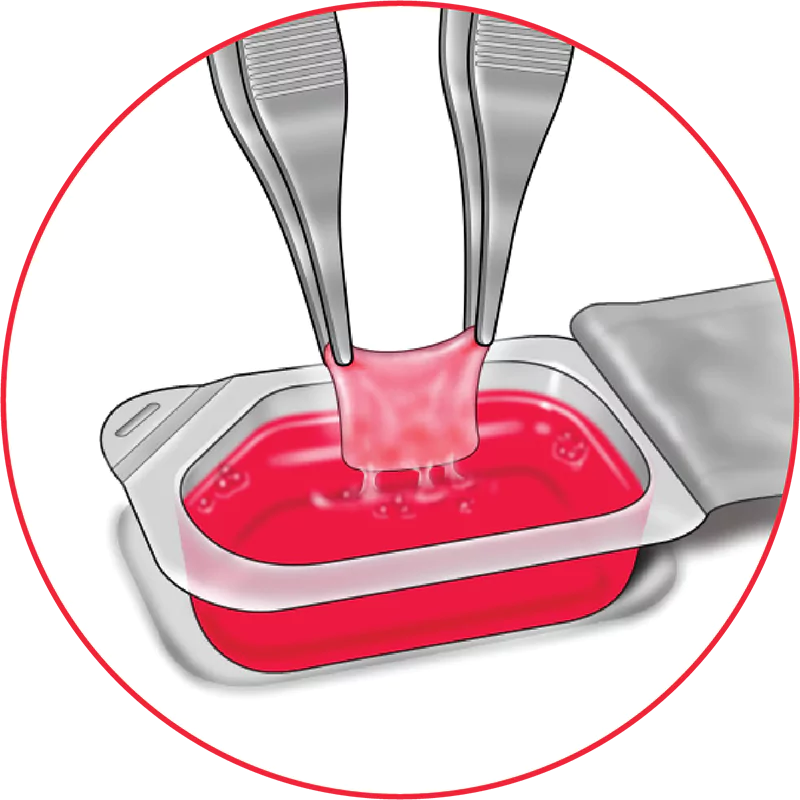 Remove Affinity from the inner tray using sterile technique, like forceps