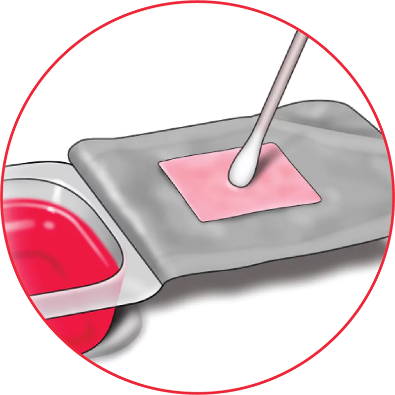 Identify stromal side of Affinity with a cotton swab